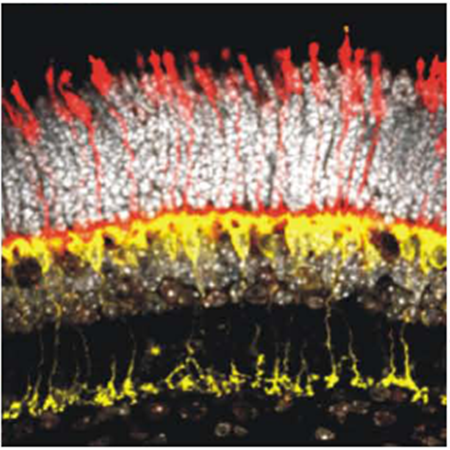 Enlarged view: Retinal Stainings