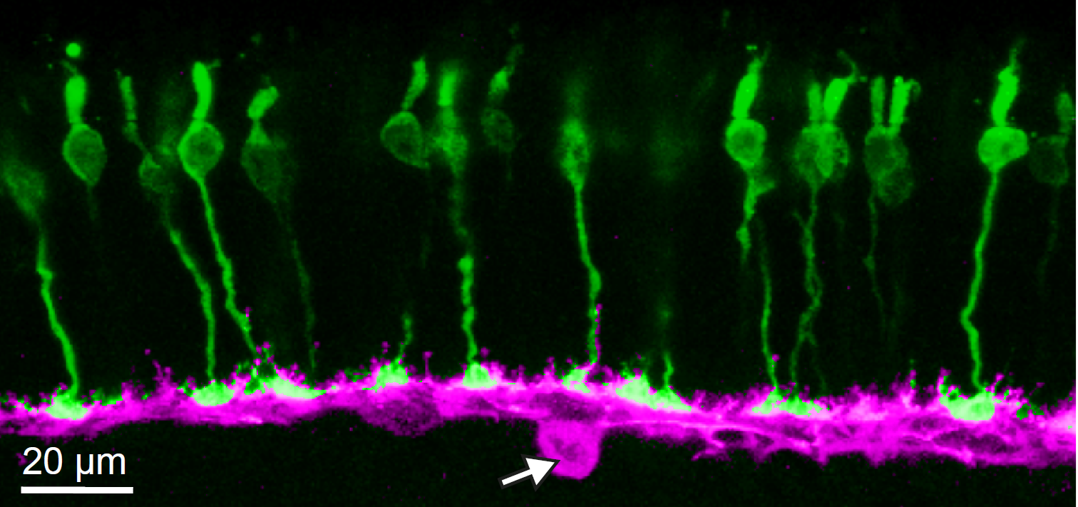 Enlarged view: Retina fluorescence image
