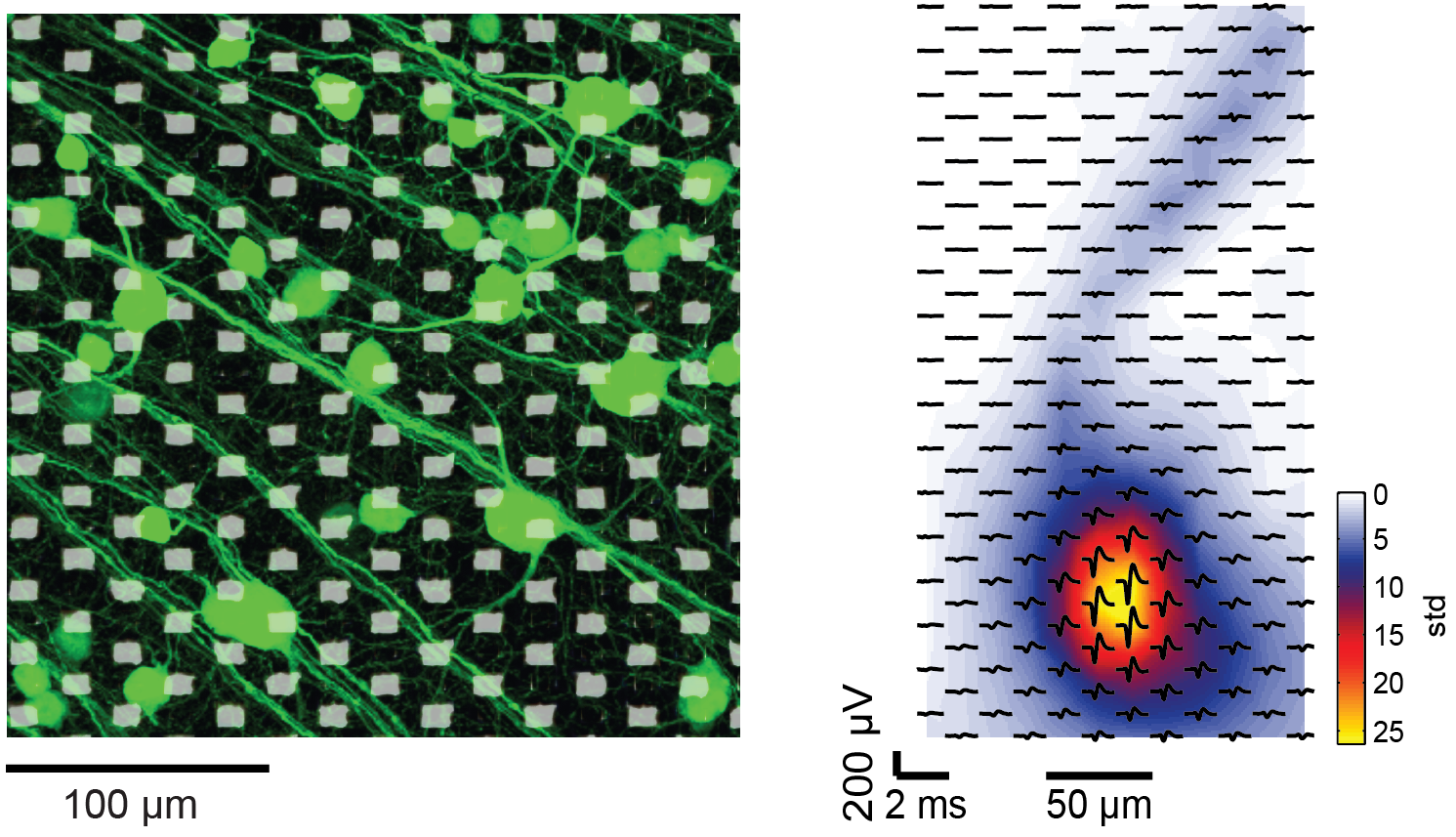 Enlarged view: Retinal Ganglion Cells on Chips