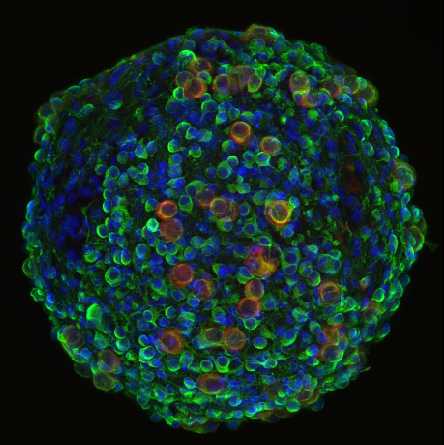 Spheroid Formation in Microfluidic Chips