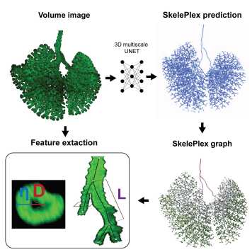Skeleplex