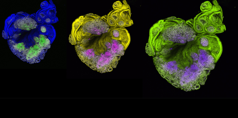 Epigenetic pathways in cancer