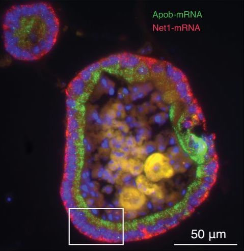 Enlarged view: Intracellular mRNA localization in mouse intestinal organoid.