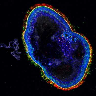 Retinal-organoid_BEL_Hierlemann