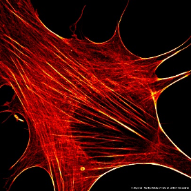Mouse fibroblast, actin filaments stained with phalloidin-Alexa488, Zeiss LSM980-Airyscan2. (photo: Javier Arias Casares, Single Cell Facility, D-BSSE/ETH Zurich)