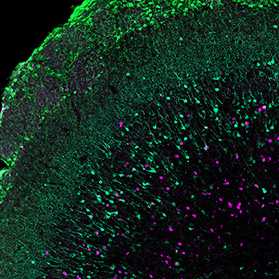 Mice-olfactory-organ_microscopic-image