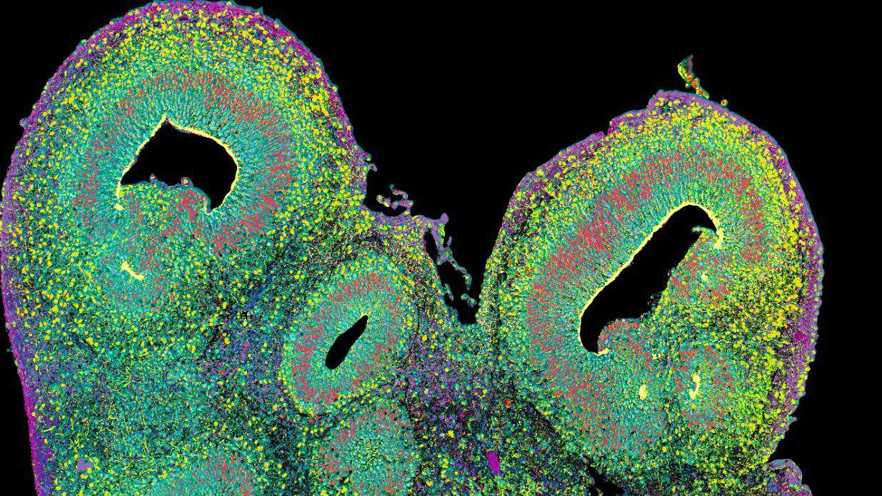 Brain-organoid_Treutlein-Lab, D-BSSE