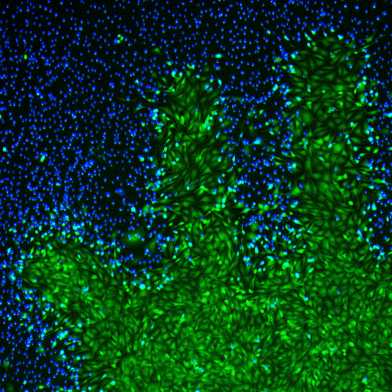 light-induced pattern of a hand formed from cells