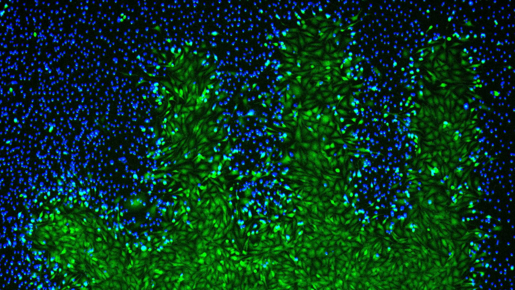 4-finger pattern formed by blue and green cells