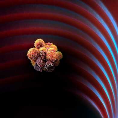 circulating tumour cells - microscopic image - recoloured