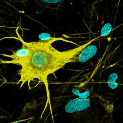 Neuron, ETH Zurich