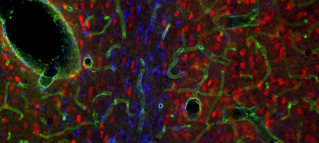 Enlarged view: brain section immunostained